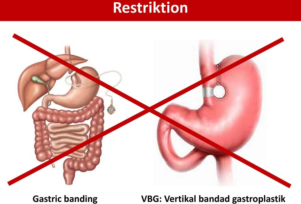 VBG: Vertikal