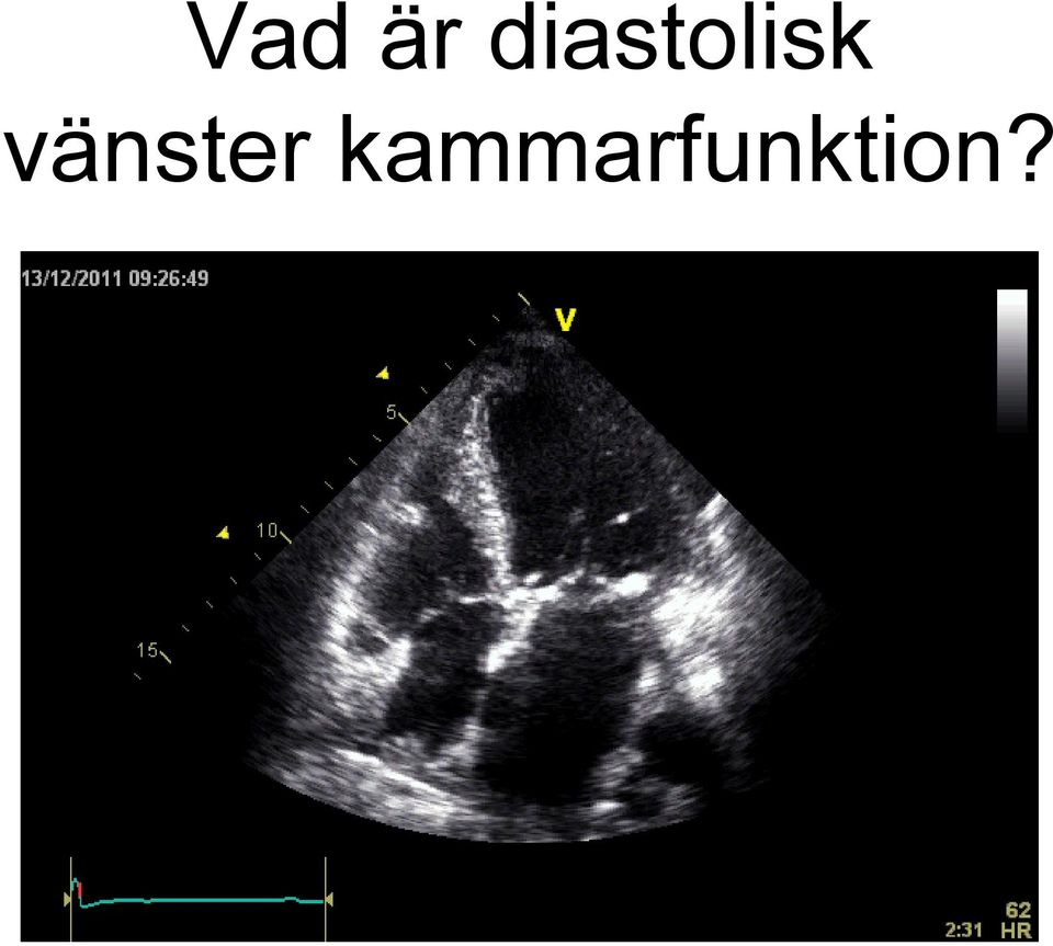 vänster