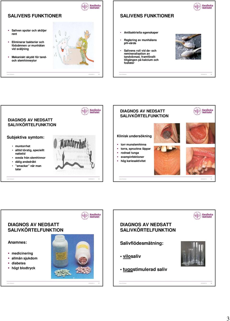 03/09/2014 14 DIAGNOS AV NEDSATT SALIVKÖRTELFUNKTION DIAGNOS AV NEDSATT SALIVKÖRTELFUNKTION Subjektiva symtom: muntorrhet alltid törstig, speciellt nattetid sveda från slemhinnor dålig andedräkt