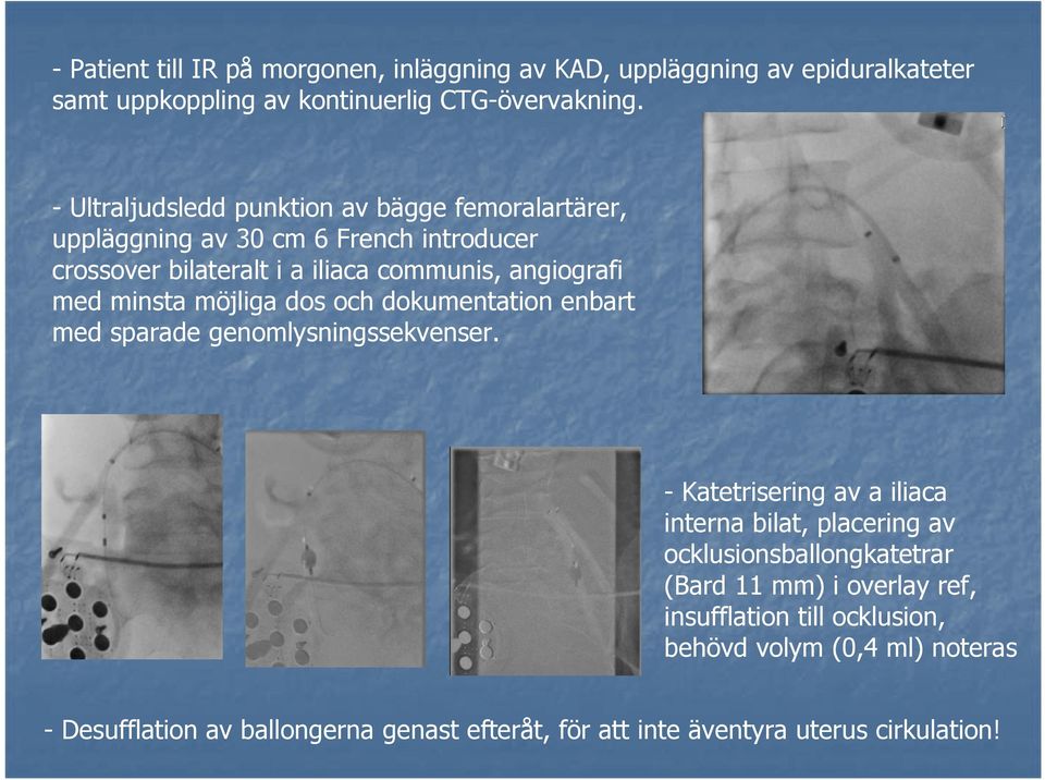 minsta möjliga dos och dokumentation enbart med sparade genomlysningssekvenser.