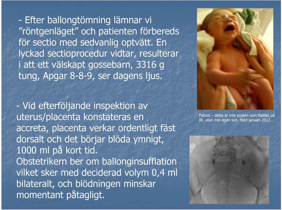 - Vid efterföljande inspektion av uterus/placenta konstateras en accreta, placenta verkar ordentligt fäst dorsalt och det börjar blöda ymnigt, 1000 ml