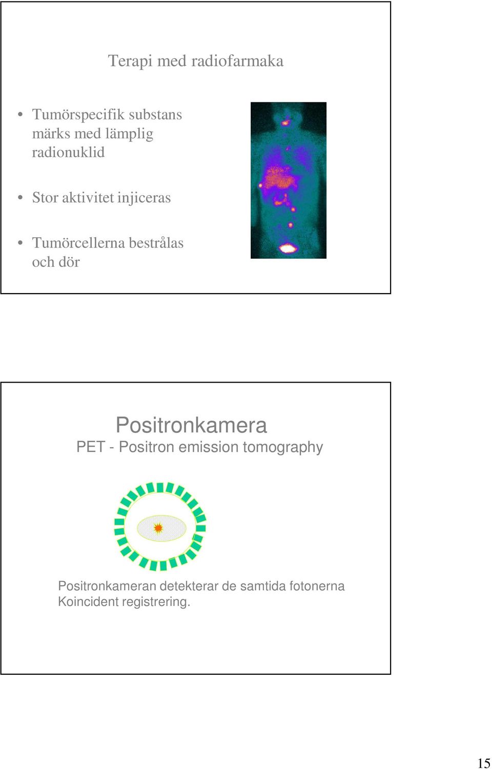 dör Positronkamera PET - Positron emission tomography