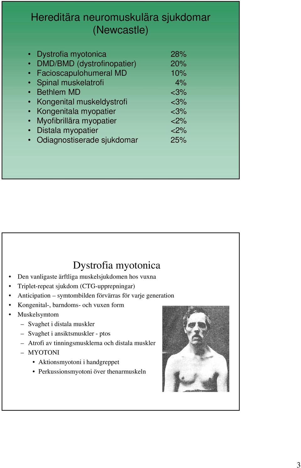ärftliga muskelsjukdomen hos vuxna Triplet-repeat sjukdom (CTG-upprepningar) Anticipation symtombilden förvärras för varje generation Kongenital-, barndoms- och vuxen form
