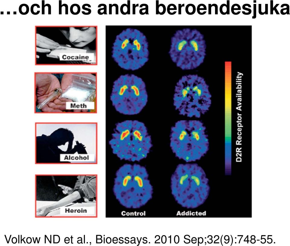 Volkow ND et al.