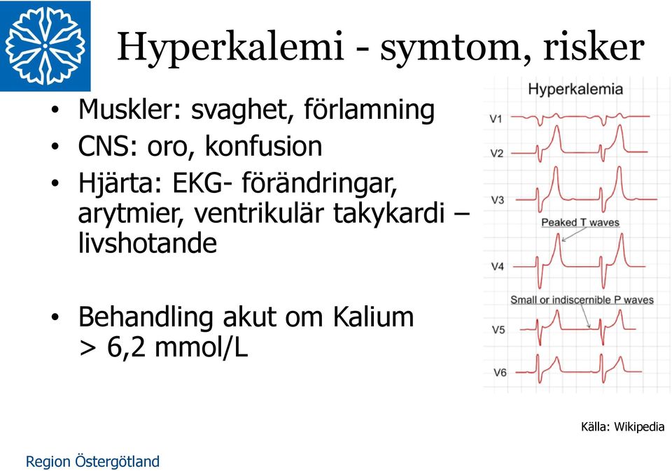 förändringar, arytmier, ventrikulär takykardi