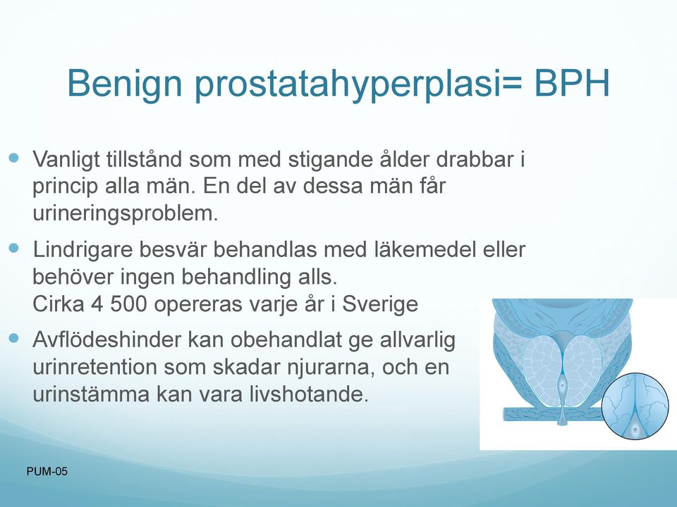 Lindrigare besvär behandlas med läkemedel eller behöver ingen behandling alls.