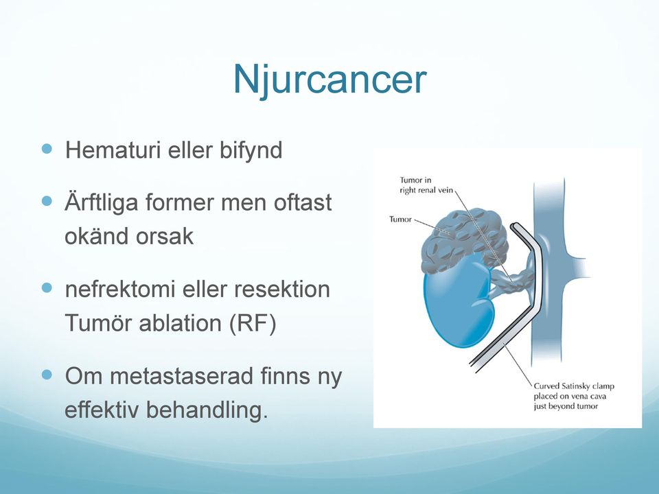 nefrektomi eller resektion Tumör