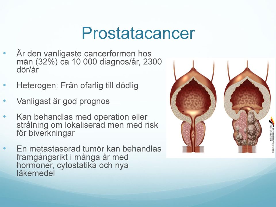 operation eller strålning om lokaliserad men med risk för biverkningar En metastaserad