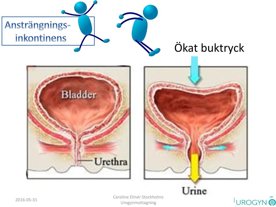 Elmér