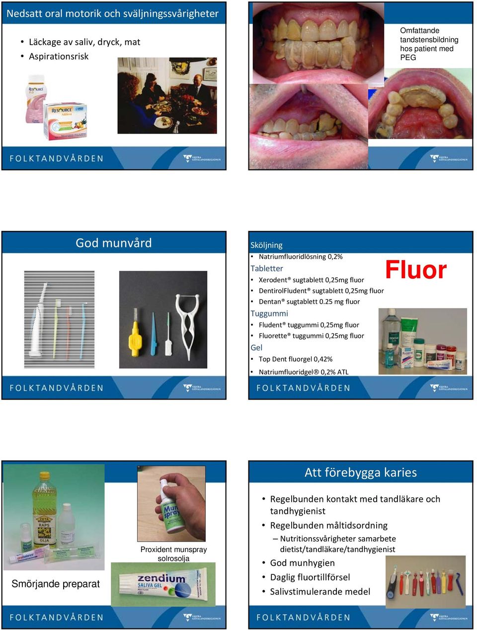 25 mg fluor Tuggummi Fludent tuggummi 0,25mg fluor Fluorette tuggummi 0,25mg fluor Gel Top Dent fluorgel 0,42% Natriumfluoridgel 0,2% ATL Fluor Att förebygga karies Smörjande