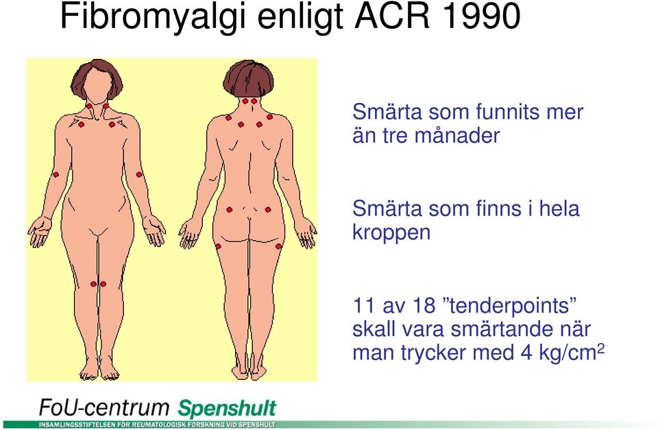 finns i hela kroppen 11 av 18 tenderpoints
