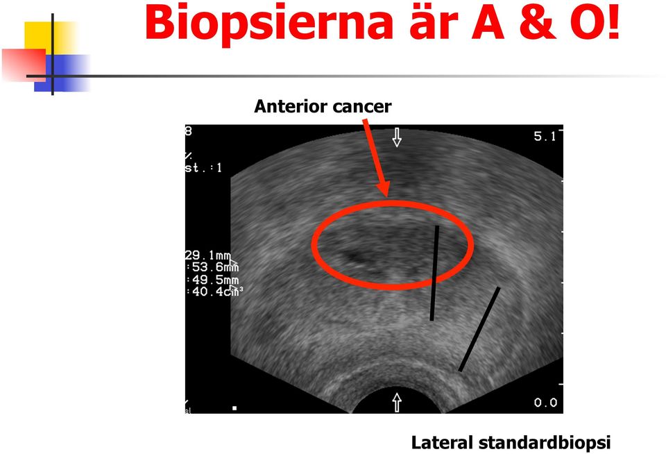 Anterior