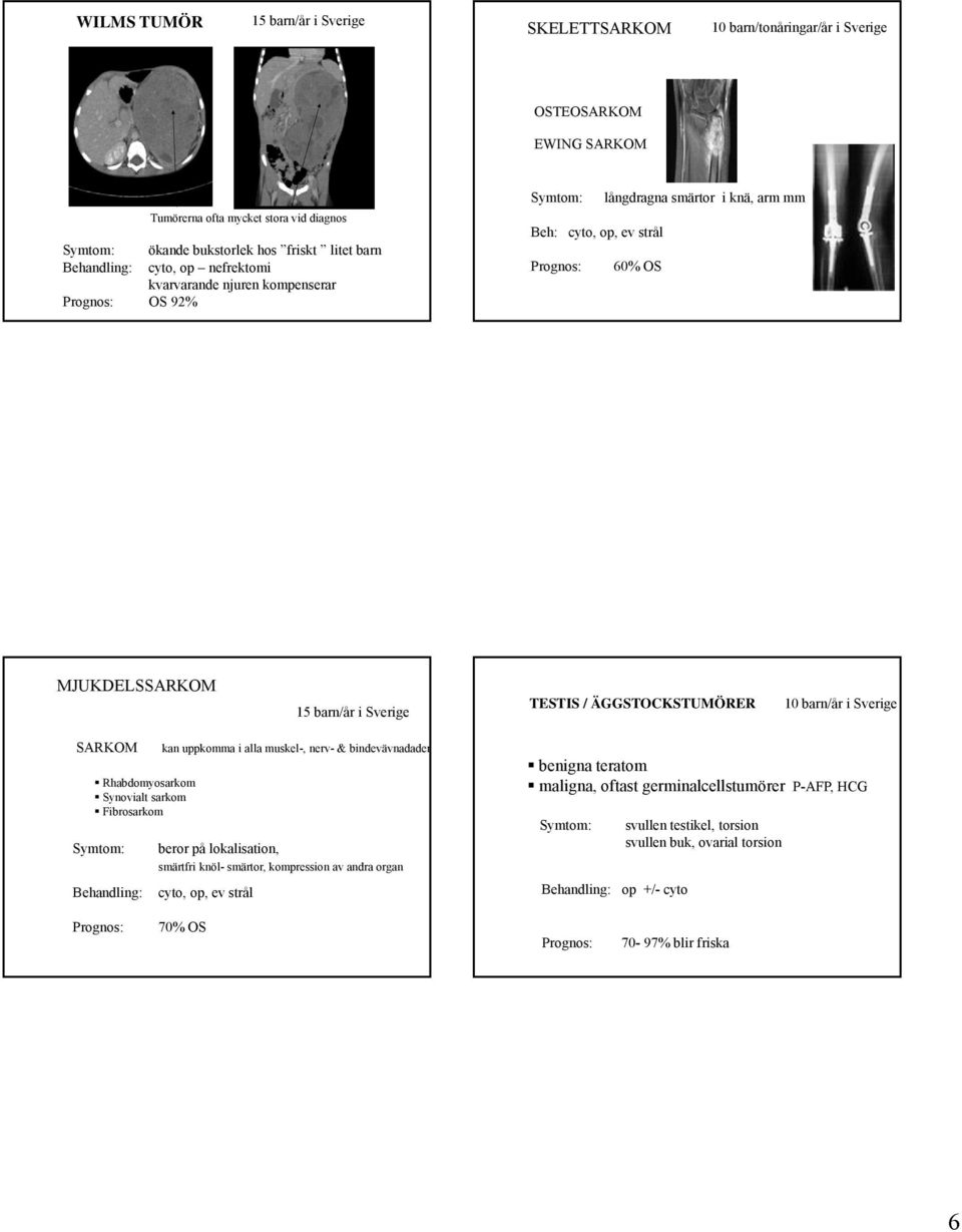 TESTIS / ÄGGSTOCKSTUMÖRER 10 barn/år i Sverige SARKOM Rhabdomyosarkom Synovialt sarkom Fibrosarkom Symtom: Behandling: kan uppkomma i alla muskel-, nerv- & bindevävnadader beror på lokalisation,