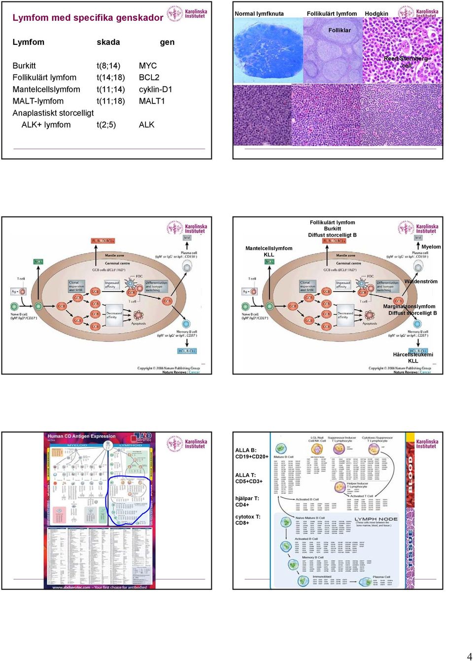 lymfom Hodgkin Folliklar Reed-Sternbergcell Follikulärt lymfom Burkitt Diffust storcelligt B Mantelcellslymfom KLL Myelom