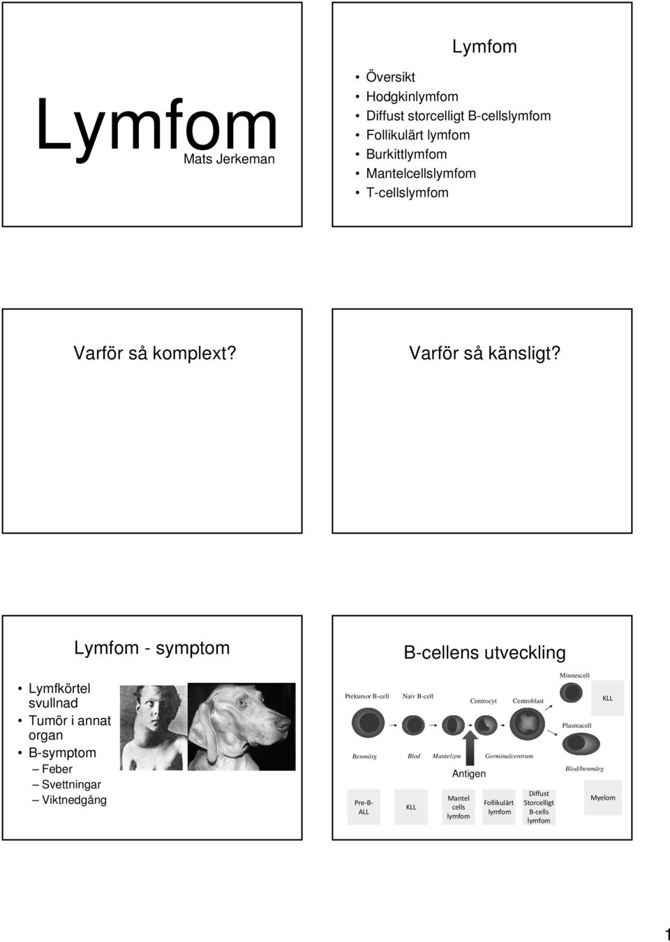 Lymfkörtel svullnad Tumör i annat organ B-symptom Feber Svettningar Viktnedgång Lymfom - symptom rekursor B-cell B-cellens utveckling