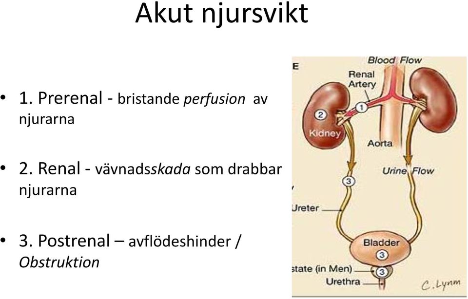 njurarna 2.