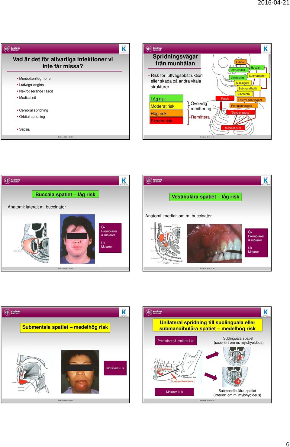 strukturer Låg risk Moderat risk Hög risk Extrem risk Överväg remittering Remittera Fascit Orbital t Infraorbitalt Vestibulärt Sublingual Buccalt Submasseter Submandibulär Submental Danger space