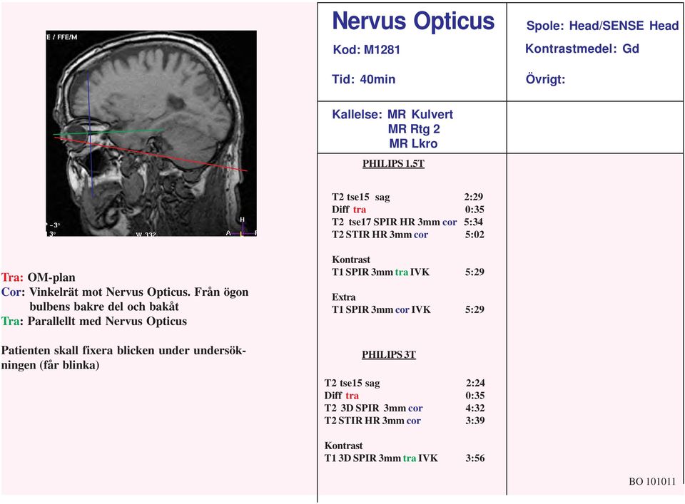 Från ögon bulbens bakre del och bakåt Tra: Parallellt med Nervus Opticus Patienten skall fixera blicken under undersökningen (får blinka) Kontrast T1
