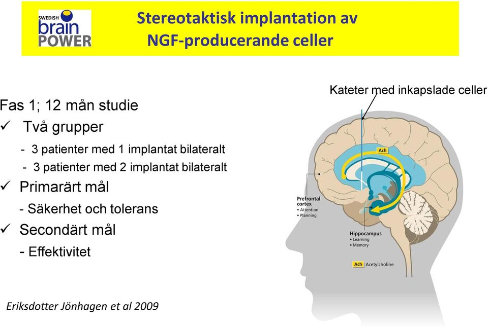 bilateralt - 3 patienter med 2 implantat bilateralt Primarärt mål -