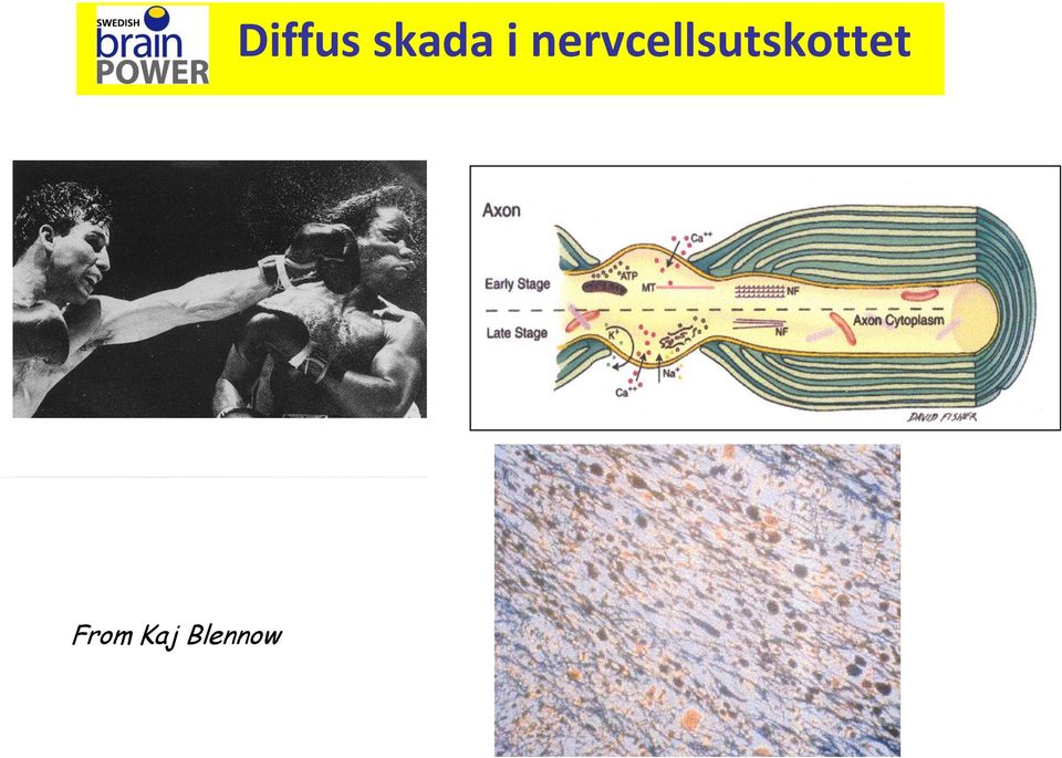 Diffus skada
