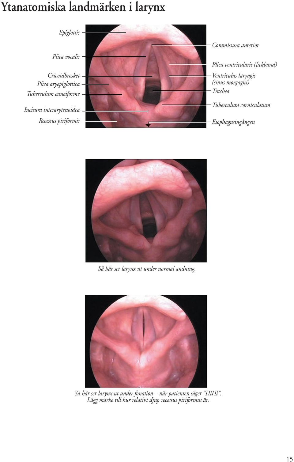laryngis (sinus morgagni) Trachea Tuberculum corniculatum Esophagusingången Så här ser larynx ut under normal