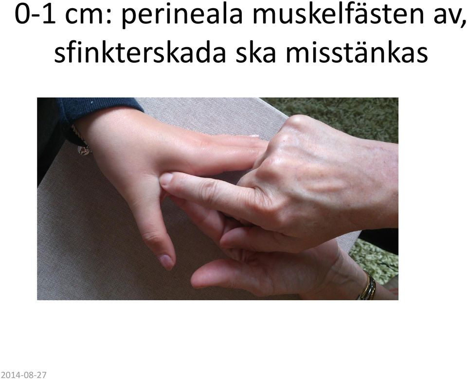 sfinkterskada ska