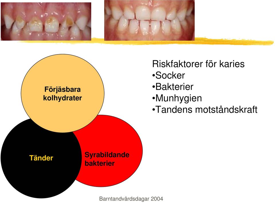 Bakterier Munhygien Tandens