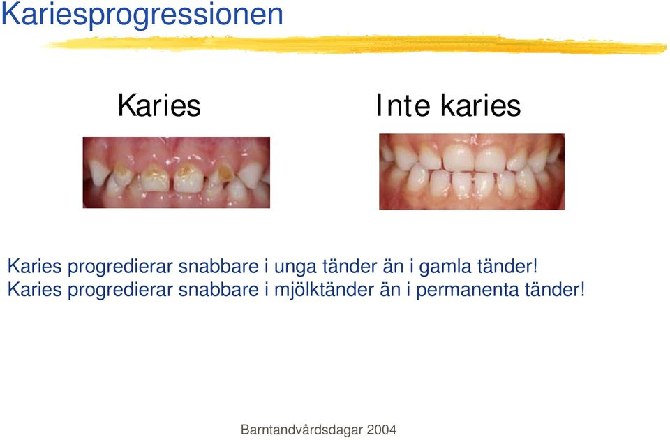 tänder än i gamla tänder!