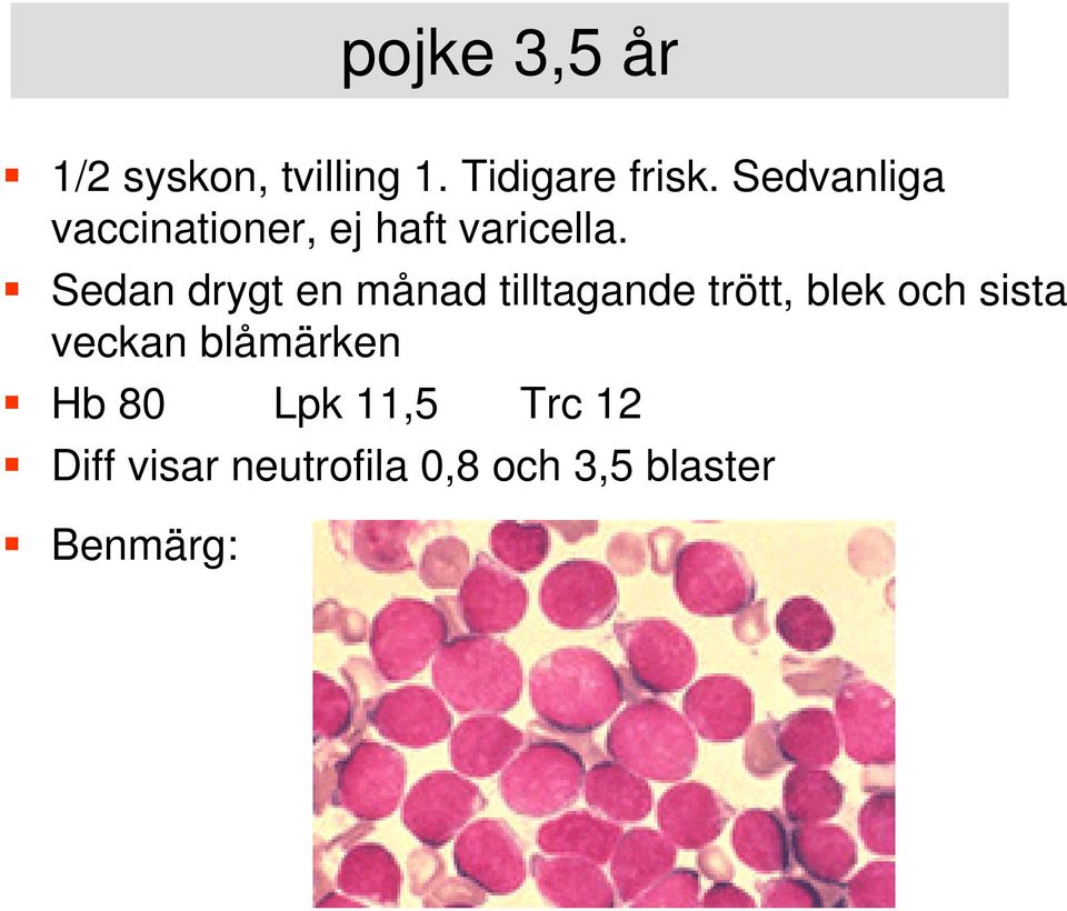 Sedan drygt en månad tilltagande trött, blek och sista