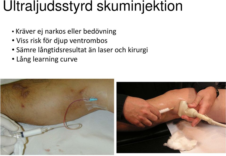 för djup ventrombos Sämre