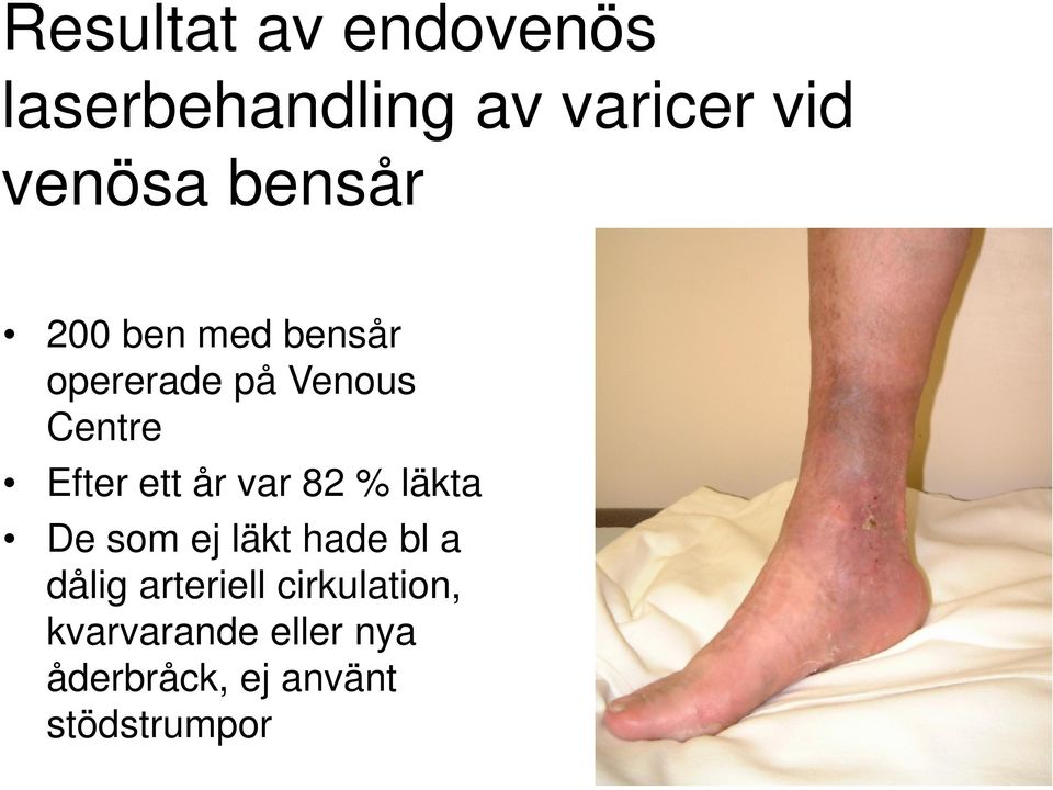 år var 82 % läkta De som ej läkt hade bl a dålig arteriell