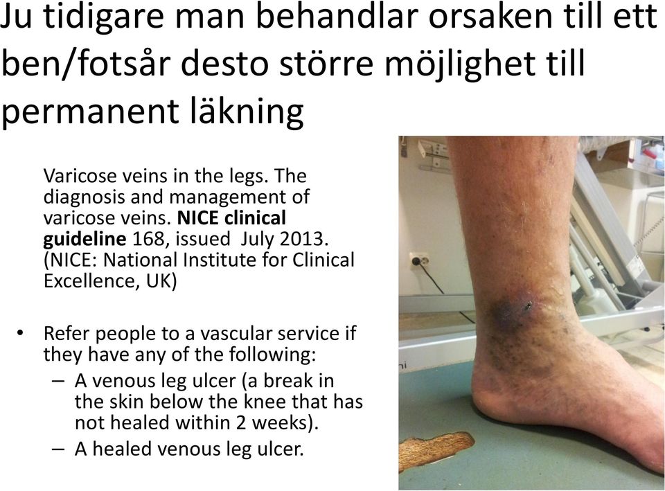(NICE: National Institute for Clinical Excellence, UK) Refer people to a vascular service if they have any of the