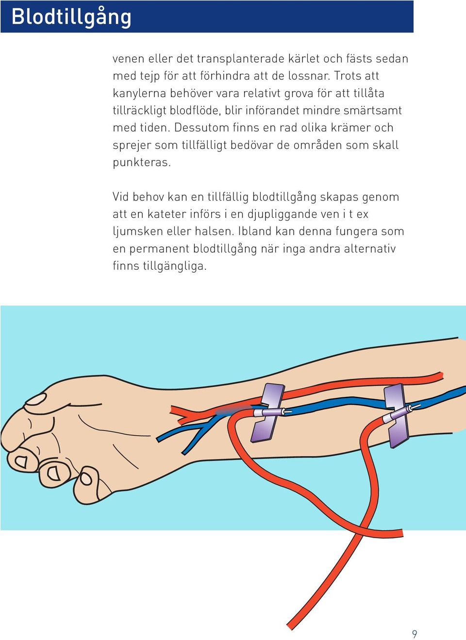 Dessutom finns en rad olika krämer och sprejer som tillfälligt bedövar de områden som skall punkteras.