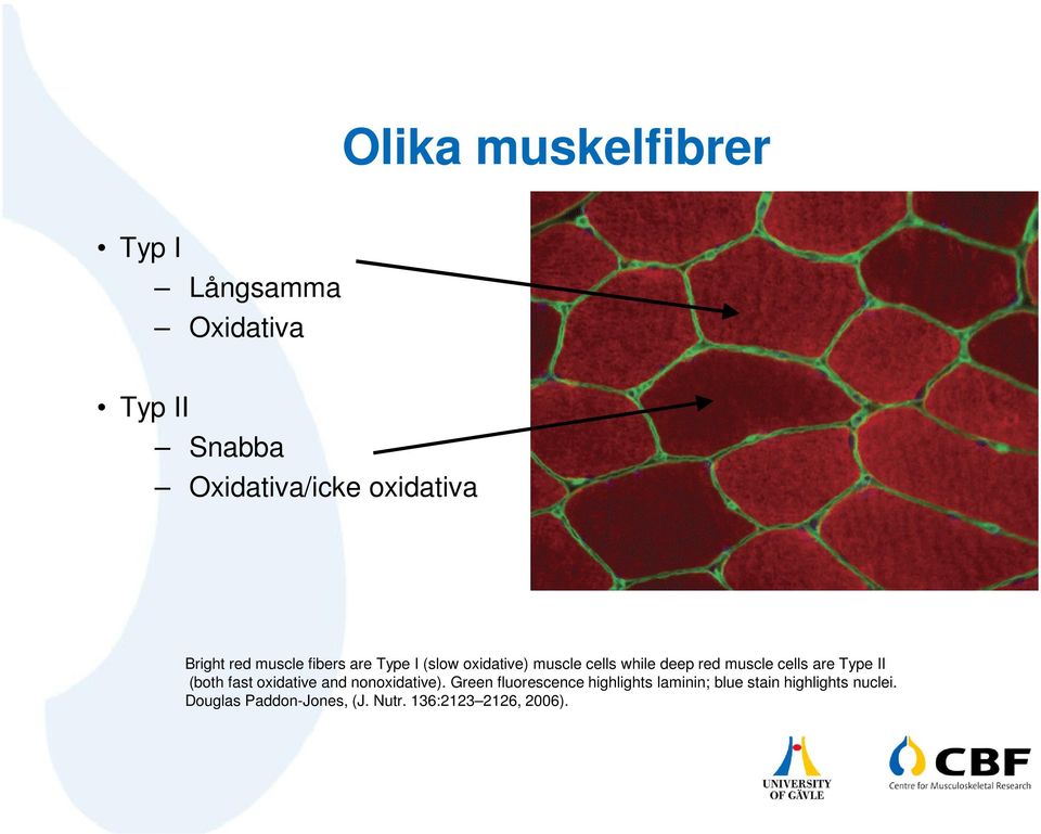 cells are Type II (both fast oxidative and nonoxidative).
