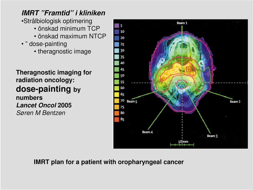 imaging for radiation oncology: dose-painting by numbers Lancet