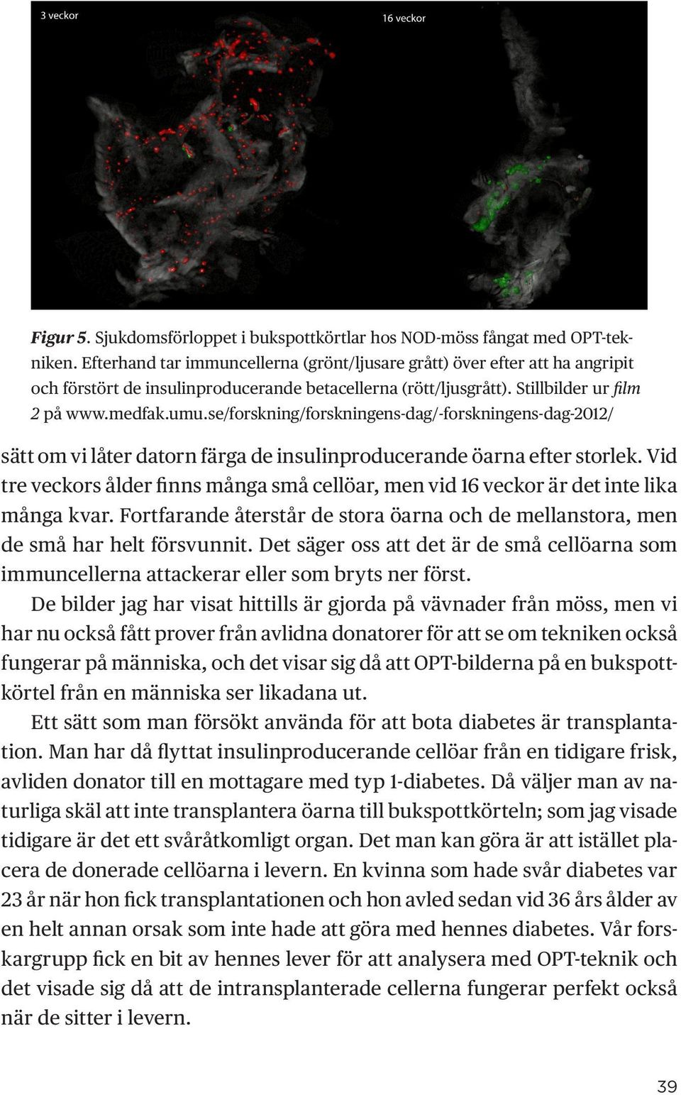 se/forskning/forskningens-dag/-forskningens-dag-2012/ sätt om vi låter datorn färga de insulinproducerande öarna efter storlek.