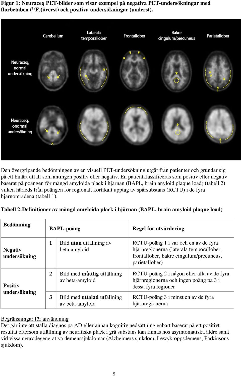 En patientklassificeras som positiv eller negativ baserat på poängen för mängd amyloida plack i hjärnan (BAPL, brain anyloid plaque load) (tabell 2) vilken härleds från poängen för regionalt