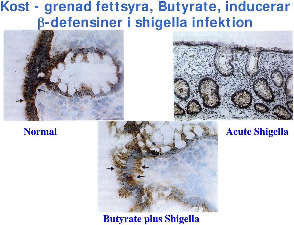 β-defensiner i shigella