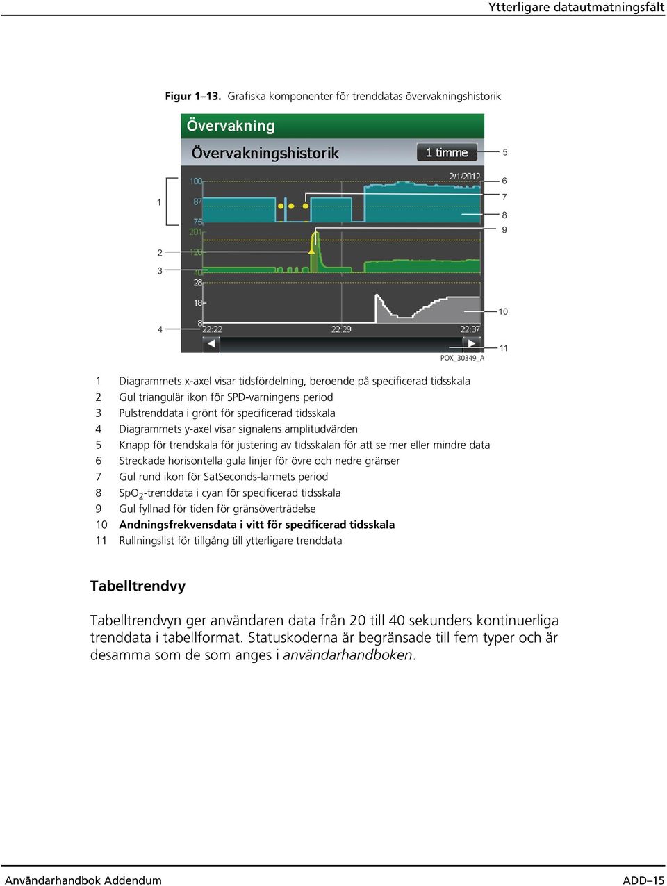 i grönt för specificerad tidsskala 4 Diagrammets y-axel visar signalens amplitudvärden 5 Knapp för trendskala för justering av tidsskalan för att se mer eller mindre data 6 Streckade horisontella