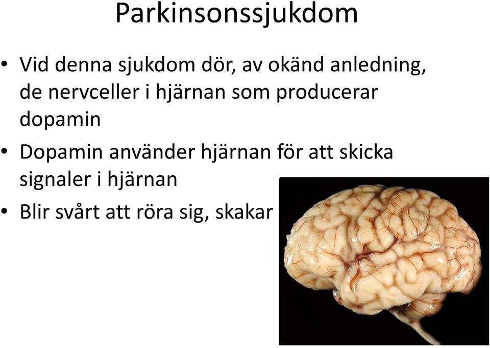 dopamin Dopamin använder hjärnan för att skicka