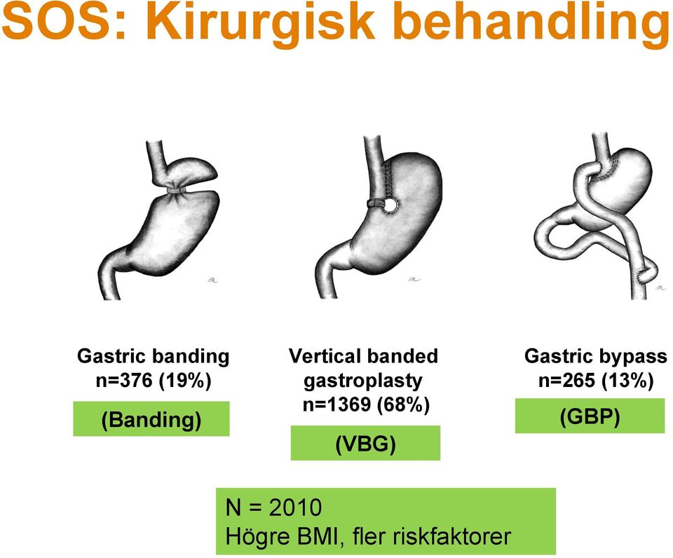 banded gastroplasty n=1369 (68%) (VBG) Gastric