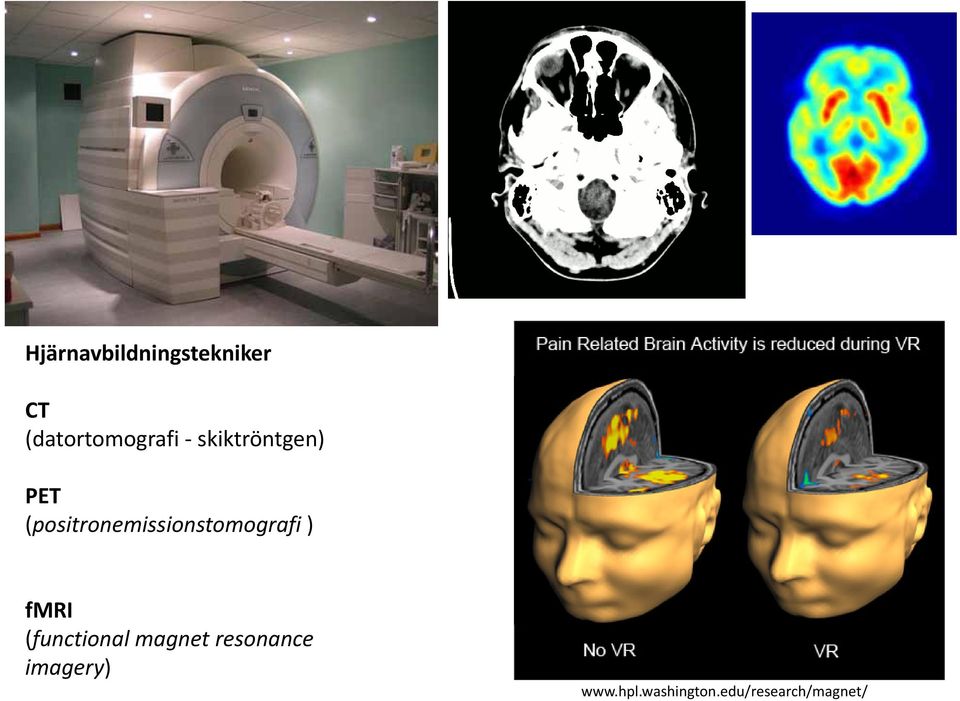 (positronemissionstomografi ) fmri