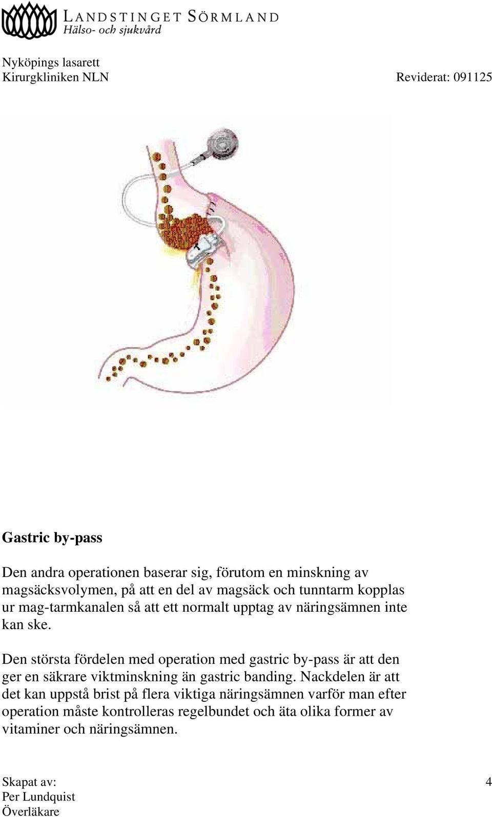 Den största fördelen med operation med gastric by-pass är att den ger en säkrare viktminskning än gastric banding.