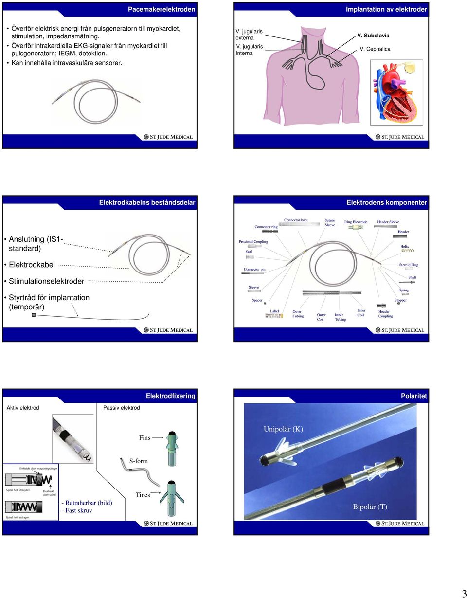 Cephalica Elektrodkabelns beståndsdelar Elektrodens komponenter Anslutning (IS1- standard) Seal Connector boot Connector ring Proximal Coupling Suture Sleeve Ring Electrode Header Sleeve Header Helix