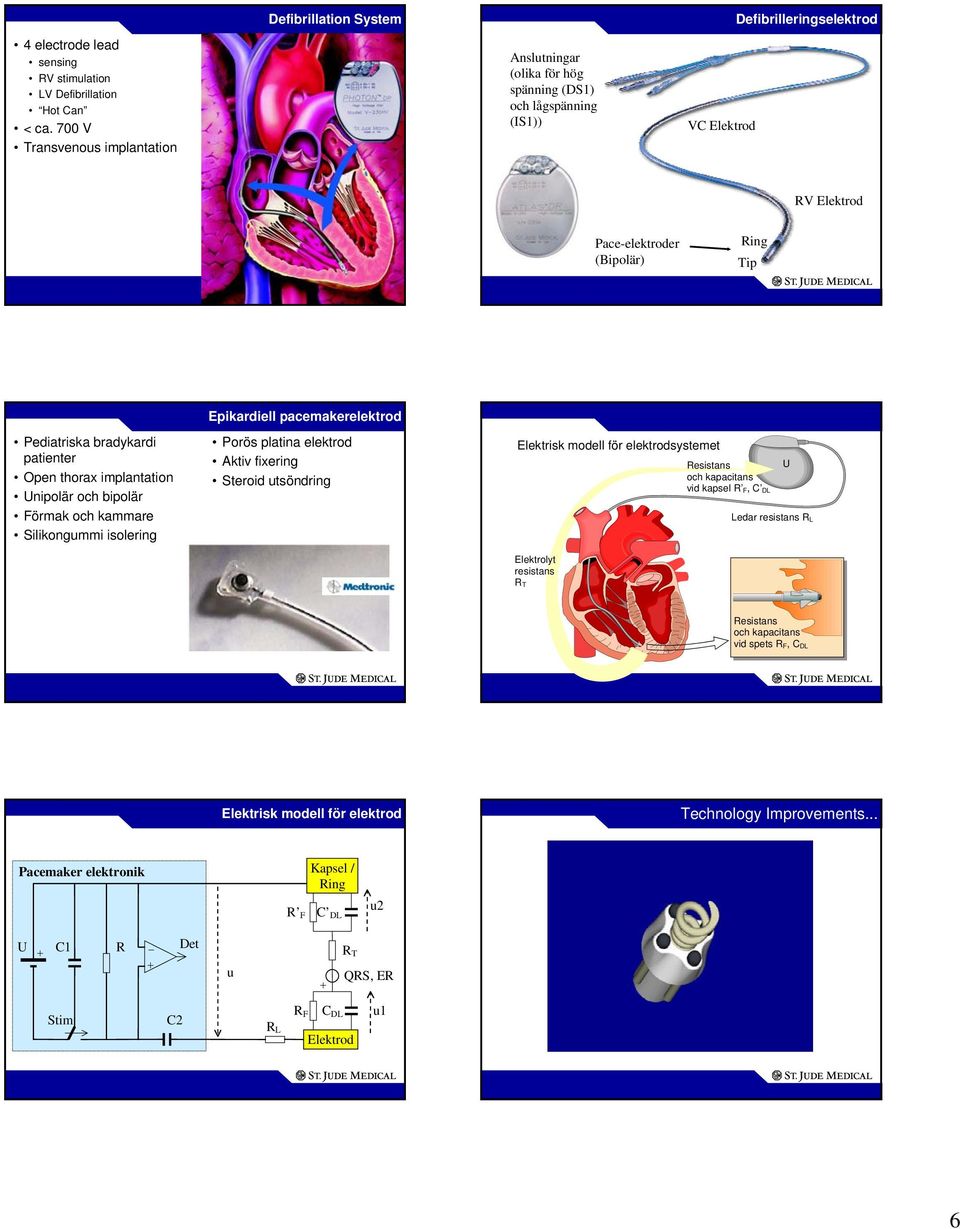bradykardi patienter Open thorax implantation Unipolär och bipolär Förmak och kammare Silikongummi isolering Porös platina elektrod Aktiv fixering Steroid utsöndring Elektrisk modell för