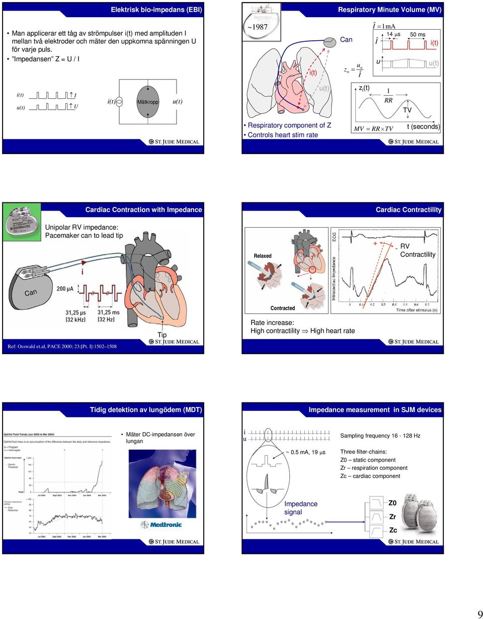 Contraction with Impedance Cardiac Contractility Unipolar RV impedance: Pacemaker can to lead tip Relaxed + - RV Contractility Can Ref: Osswald et.al, PACE 2000; 23:[Pt.