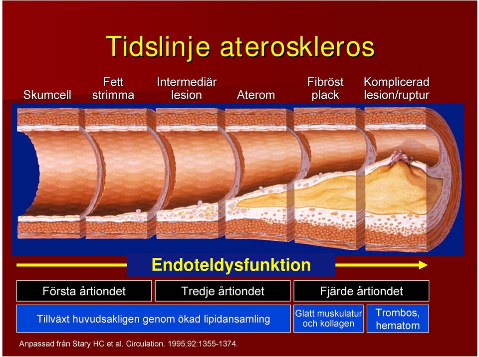 Fjärde årtiondet Tillväxt huvudsakligen genom ökad lipidansamling Anpassad från