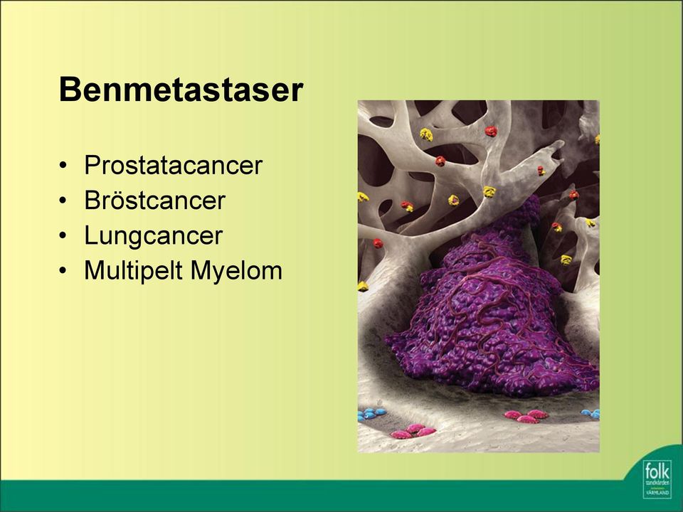 Bröstcancer