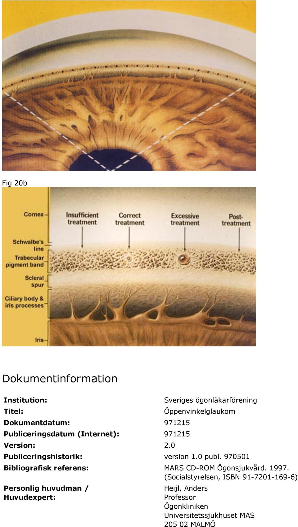 0 publ. 970501 Bibliografisk referens: MARS CD-ROM Ögonsjukvård. 1997.