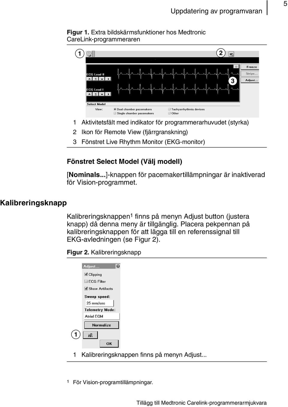 Rhythm Monitor (EKG-monitor) Fönstret Select Model (Välj modell) [Nominals...]-knappen för pacemakertillämpningar är inaktiverad för Vision-programmet.